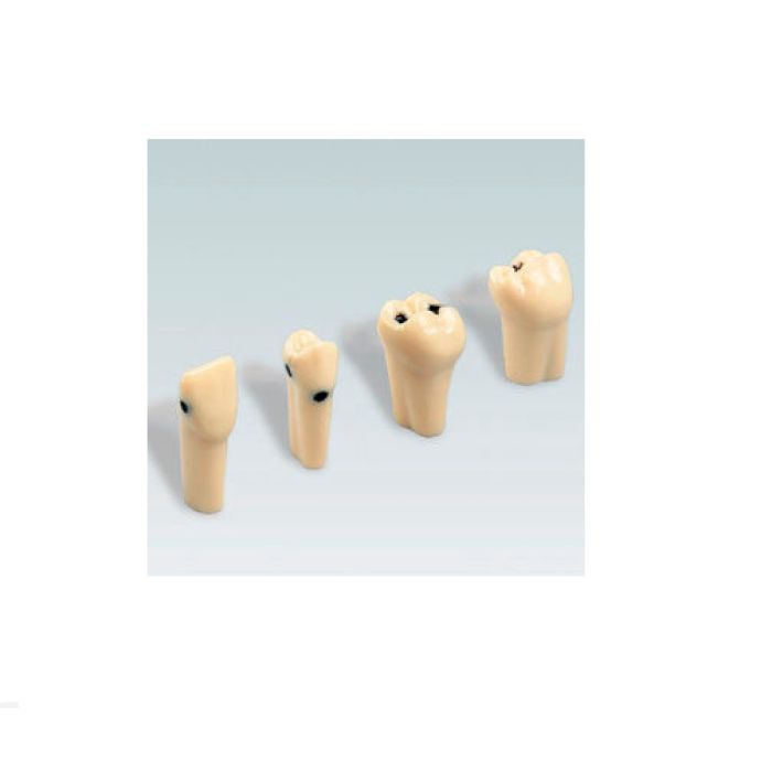 AG-3 ZKN TOOTH NO 46 WITH CARIOUS